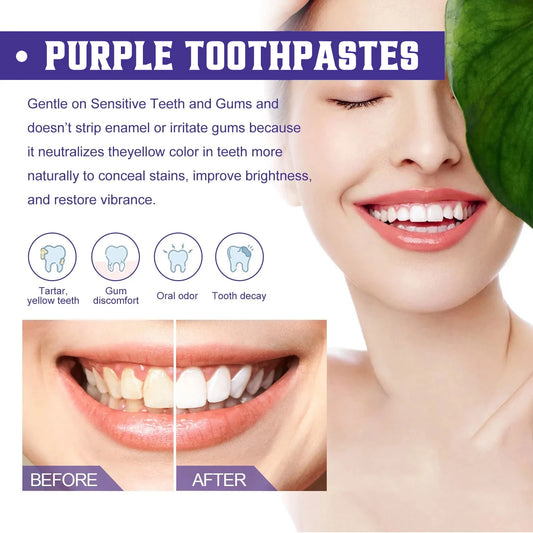 2x1 Tiras Blanqueadoras Dentales Premium – 7 Piezas
