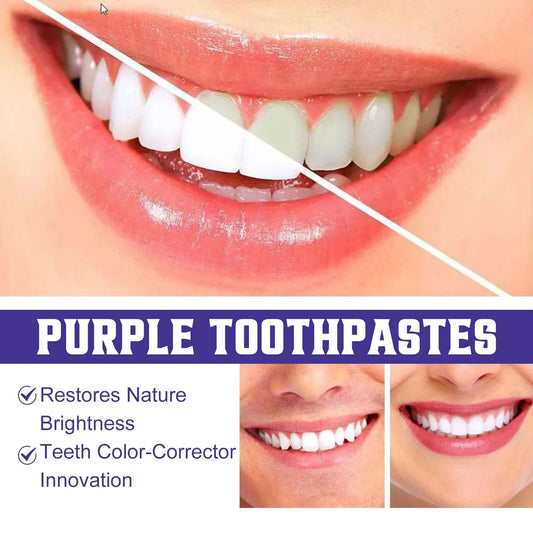Kit Blanqueamiento Dental Completo – Pasta + 2 Tiras Premium